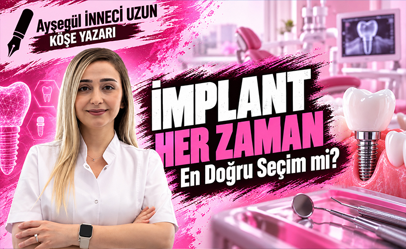 İmplant Her Zaman En Doğru Seçim mi?
